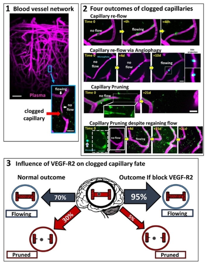 Mapping and manipulating the fate of clogged brain capillaries